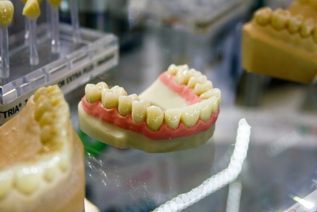 bitemark evidence uses a mold of teeth